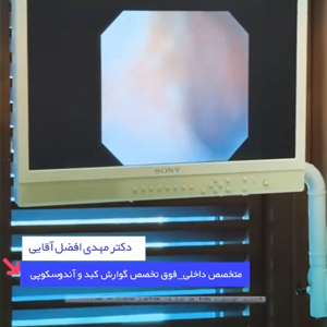 نکات انجام آندوسکوپی معده