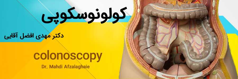 کولونوسکوپی در مطب دکتر مهدی افضل آقایی