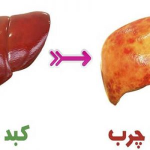 کبد سالم داشته باشیم